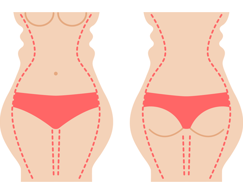 Body Contouring